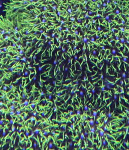 GSP frag